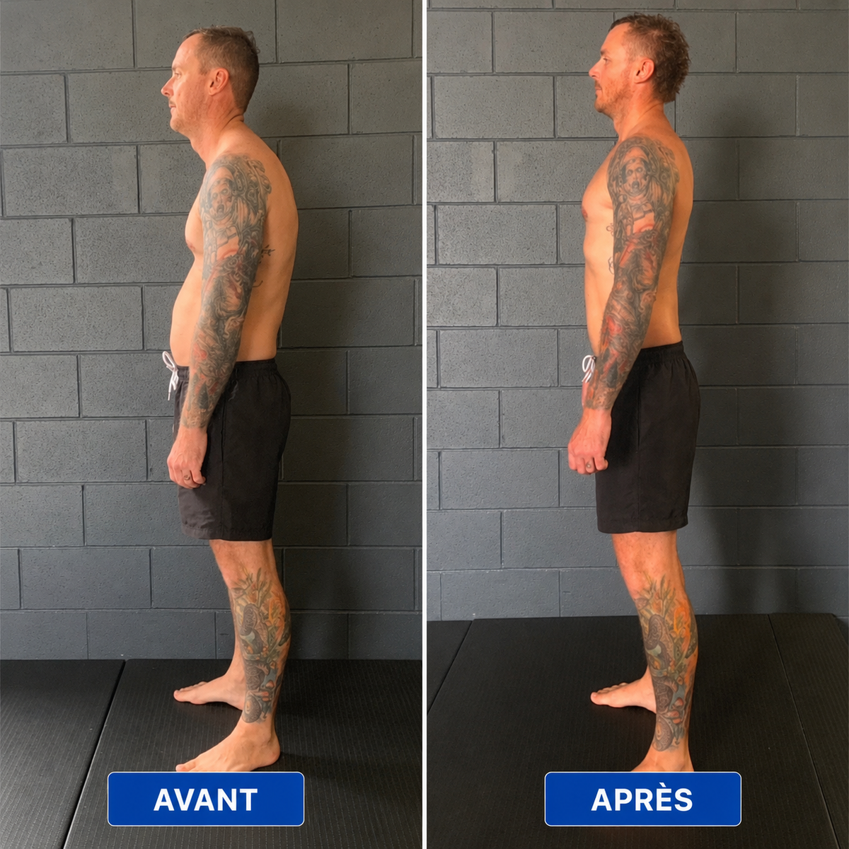 Naevyo™ – Correcteur de Posture